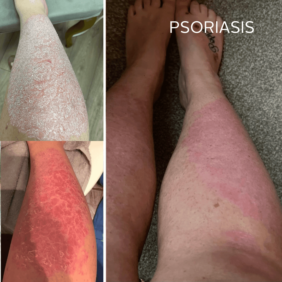 Rescue Serum - Raven Botanicals