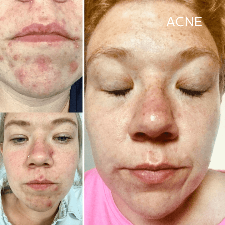 Rescue Serum - Raven Botanicals