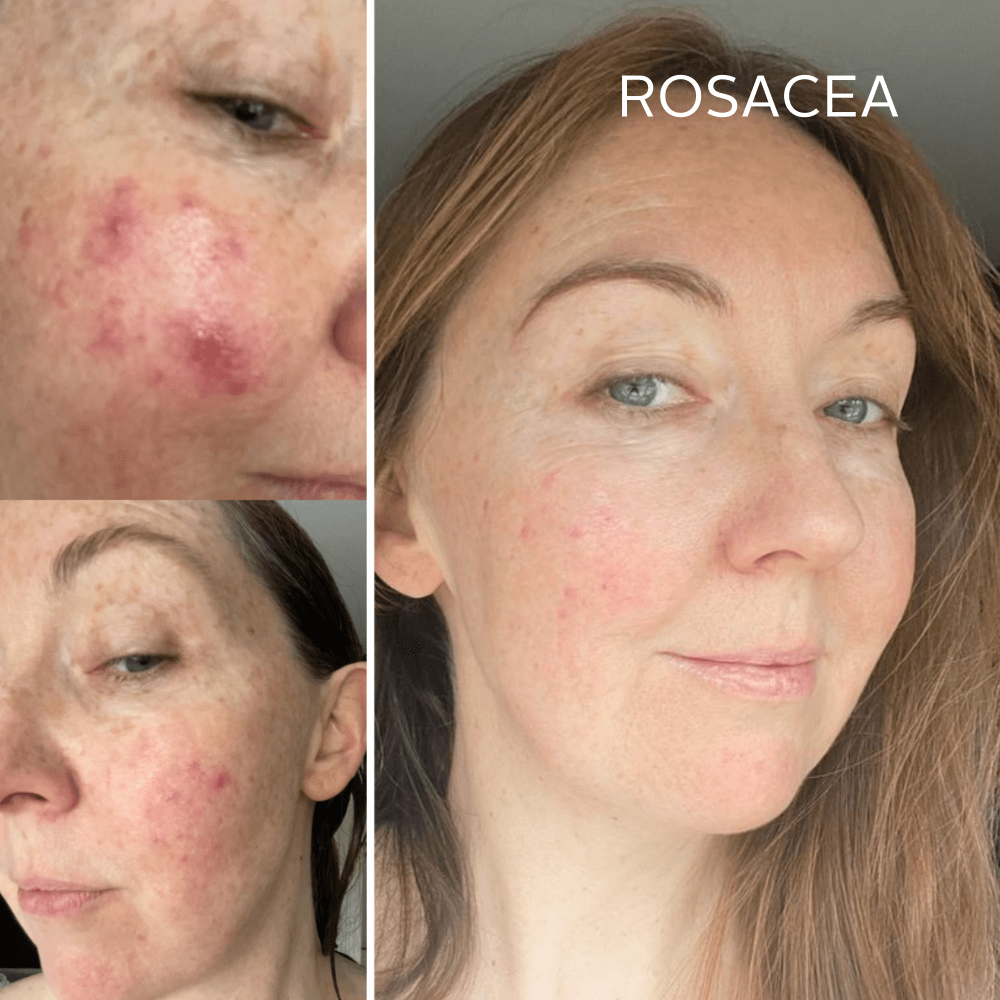 Rescue Serum - Raven Botanicals