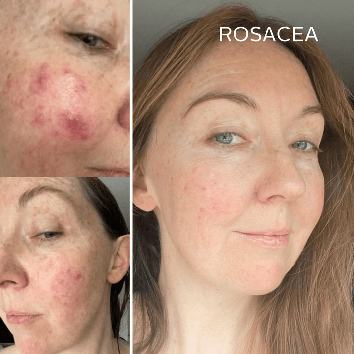 Rescue Serum - Raven Botanicals