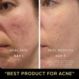 Sensitive Skin Starter Routine - Raven Botanicals