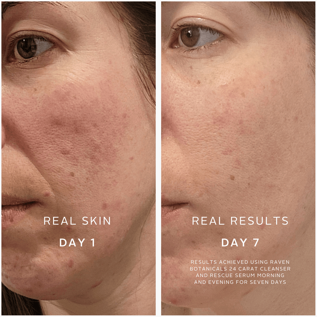 Soothing Superheroes - Raven Botanicals