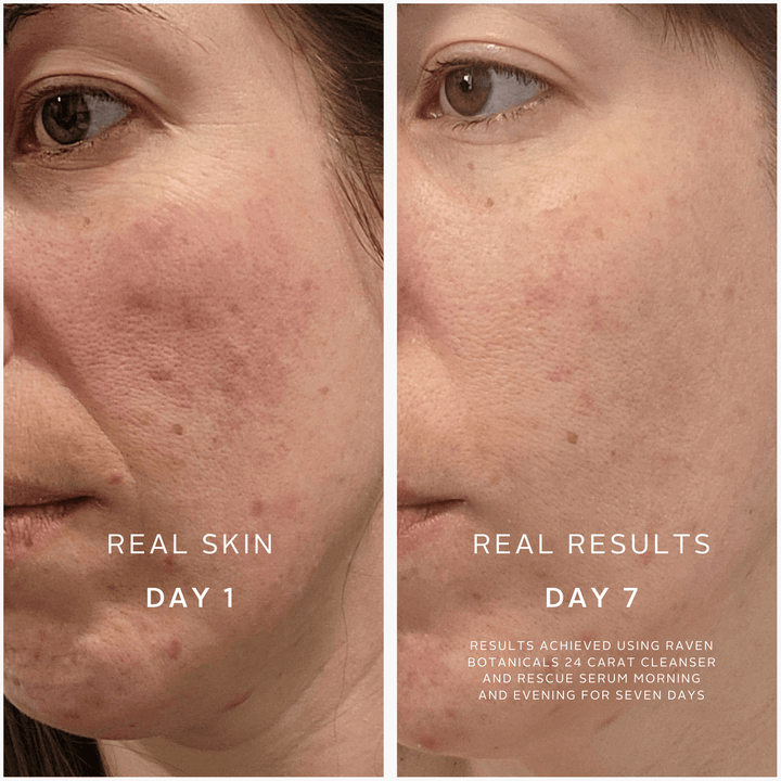 Soothing Superheroes - Raven Botanicals